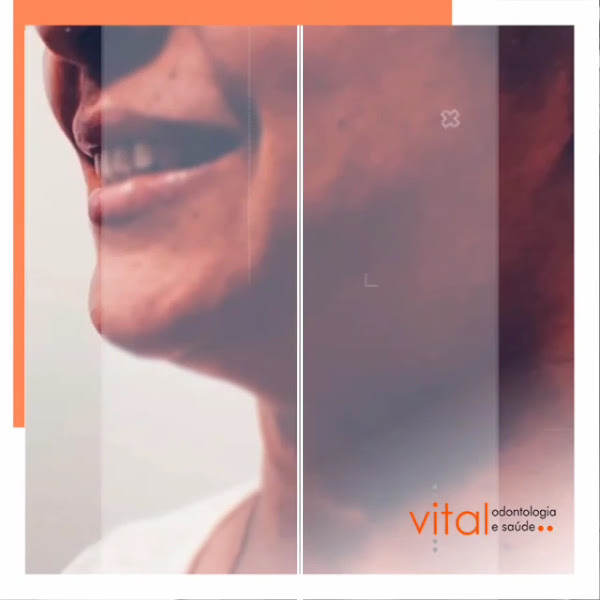 Foto 4 de Vital Odontologia e Saúde