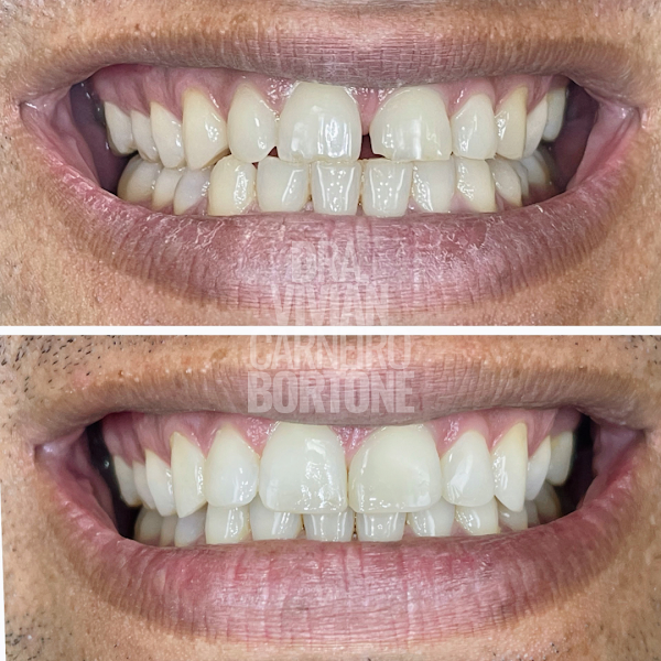 Foto 2 de VITALI Odontologia Especializada