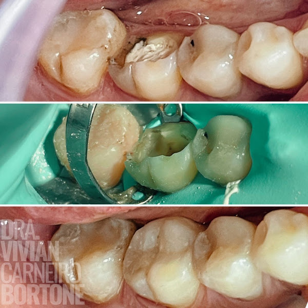 Foto 3 de VITALI Odontologia Especializada