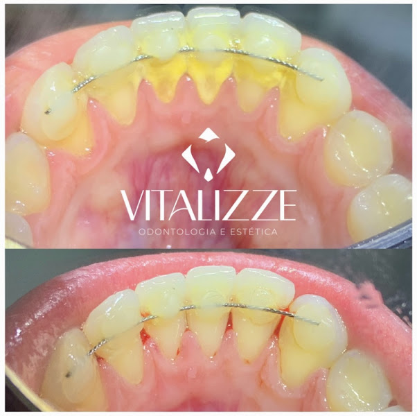 Foto 3 de Vitalizze Odontologia e Estética