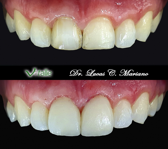 Foto 2 de Vitalle Odontologia | Implante Dentário | Ortodontia | Dentista em Gama, Brasília