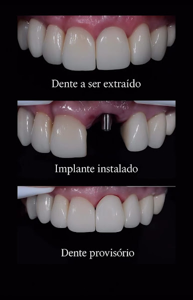 Foto 3 de Vitalle Odontologia | Implante Dentário | Ortodontia | Dentista em Gama, Brasília