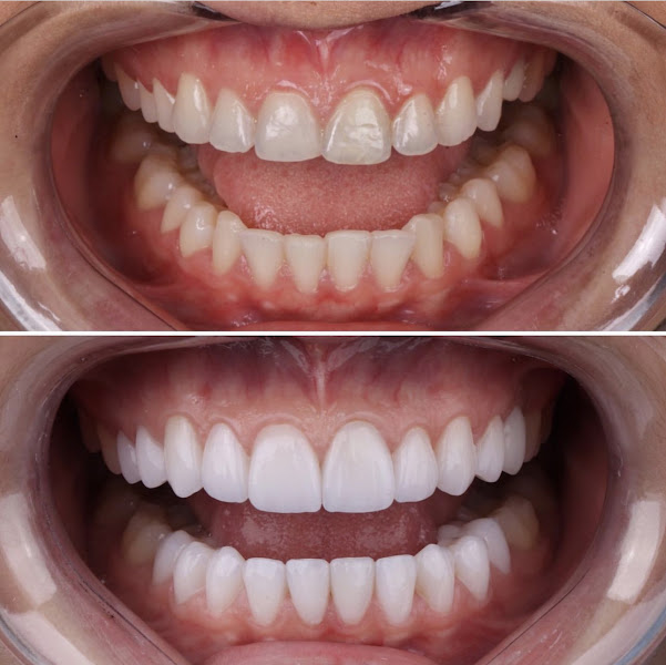 Foto 2 de Vitta Odonto Implantes ( Campo grande Cariacica )