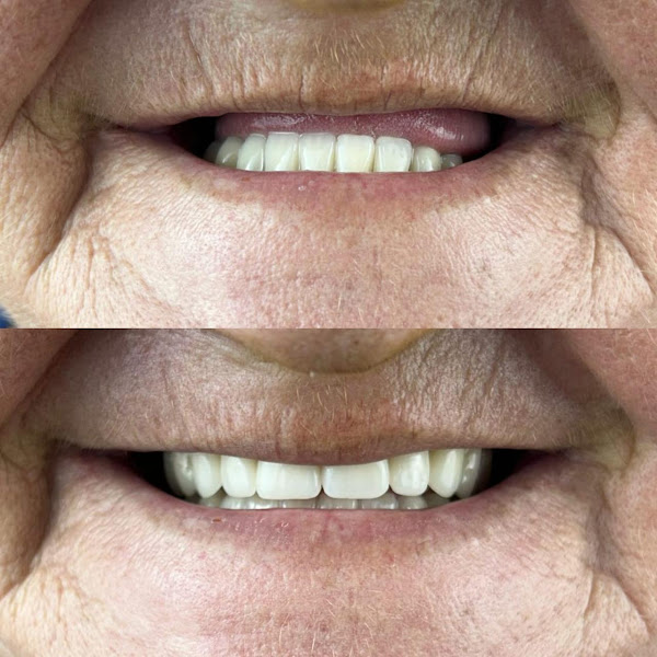 Foto 3 de Vitta Odonto Implantes ( Campo grande Cariacica )