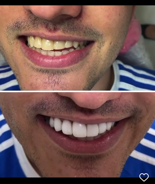 Foto 4 de Vitta Odonto Implantes ( Campo grande Cariacica )