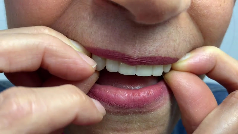 Foto 5 de Vitta Odonto Implantes ( Campo grande Cariacica )