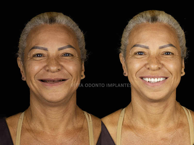 Foto de Vitta Odonto implantes Ipatinga