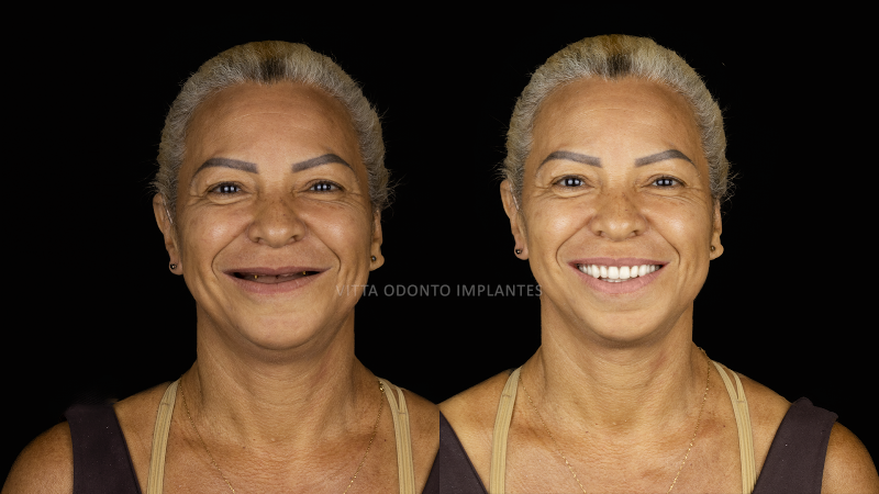 Foto 2 de Vitta Odonto implantes Ipatinga
