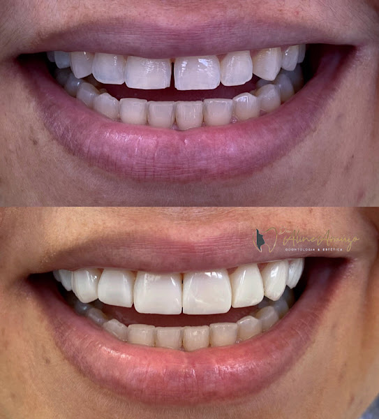 Foto 2 de Vitta Odontologia e Saúde