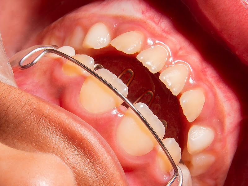 Foto 2 de Vitta OdontoMed