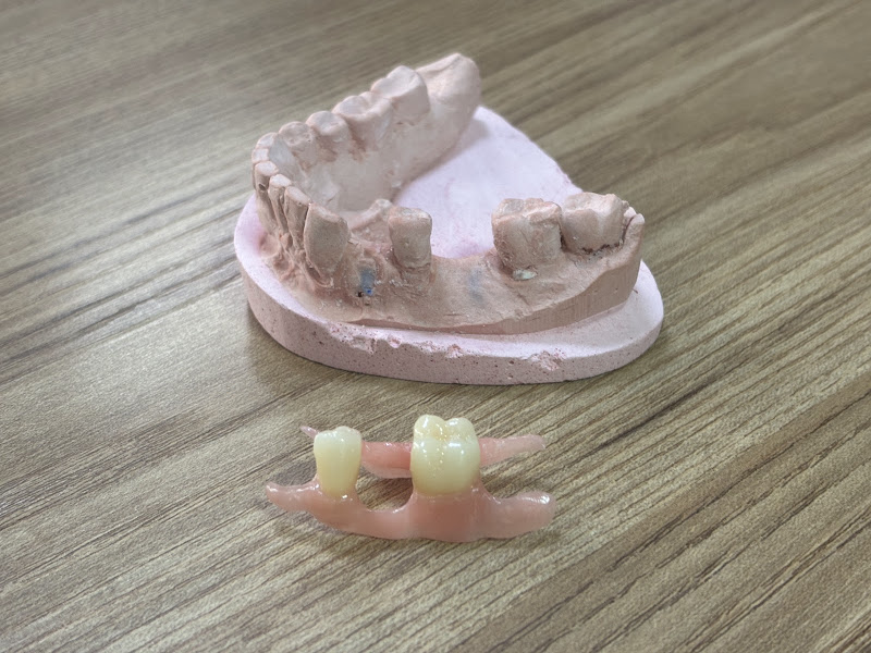 Foto 2 de Vittaé Odontologia | Implantes | Facetas | Tratamento de canal | Dentistas