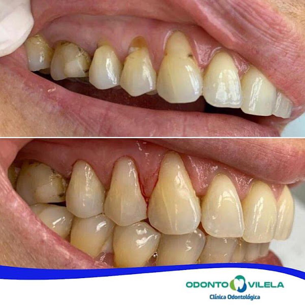 Foto 2 de Vittale Odontologia