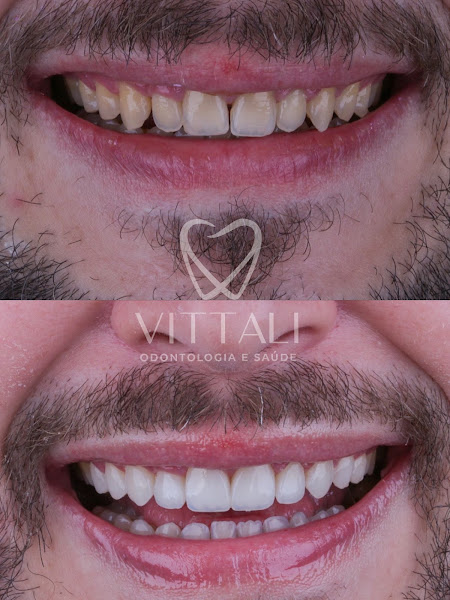 Foto 2 de Vittali Odontologia e Saúde