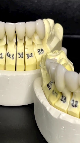 Foto 5 de Vittallon Odontologia