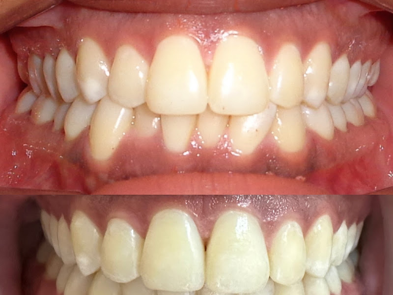 Foto 5 de Viu Odontologia - Clínica Odontológica - Jardim Bonfiglioli