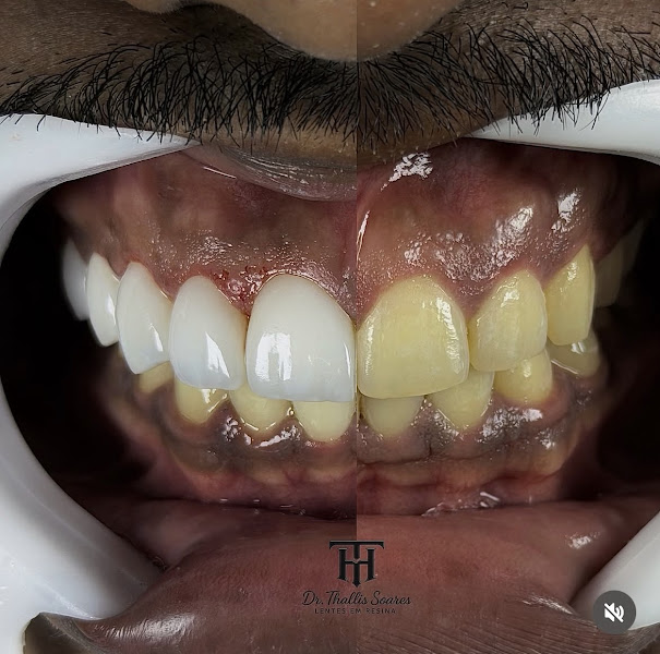 Foto 3 de Viva Sorriso