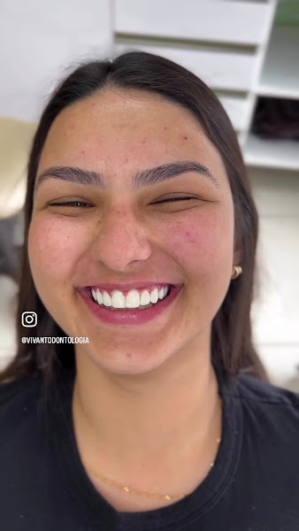 Foto 3 de Vivant Odontologia Especializada | Implantes Dentários Campina Grande