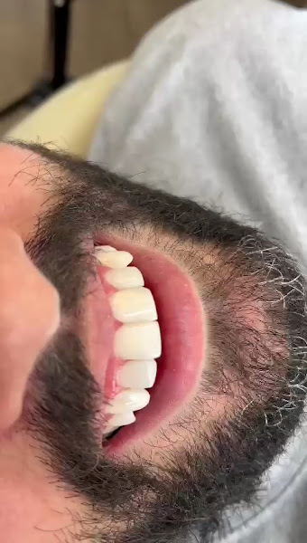 Foto 3 de Vivant Odontologia - Implantes em Itupeva
