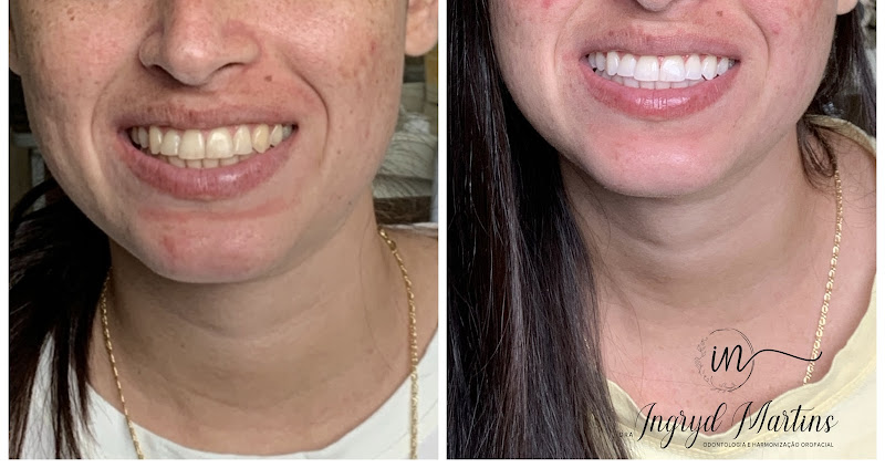 Foto 3 de Vivare Odontologia - Marabá/PA