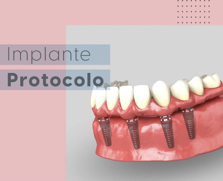 Foto 3 de Vivax Implantes e Estetica