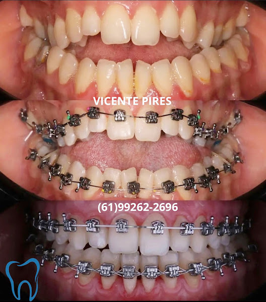 Foto 3 de VIVER SORRISO