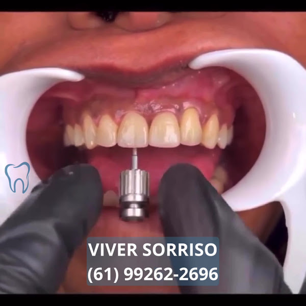 Foto 4 de VIVER SORRISO