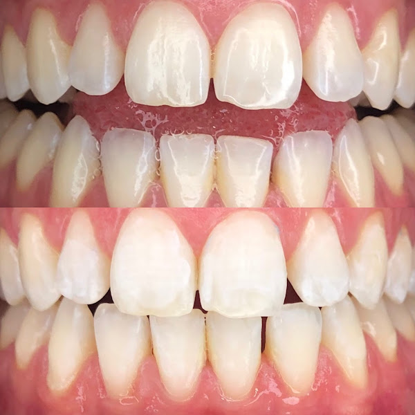 Foto 2 de Vivian Carvalho Ortodontia