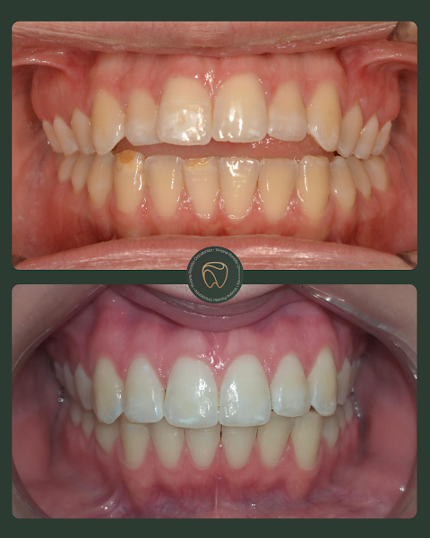 Foto 3 de Viviane Pontillo - Ortodontista em Toledo | Alinhadores Invisíveis e Aparelho Ortodôntico