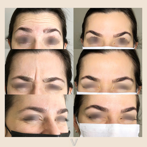 Foto 3 de Vivva Centro de Estética