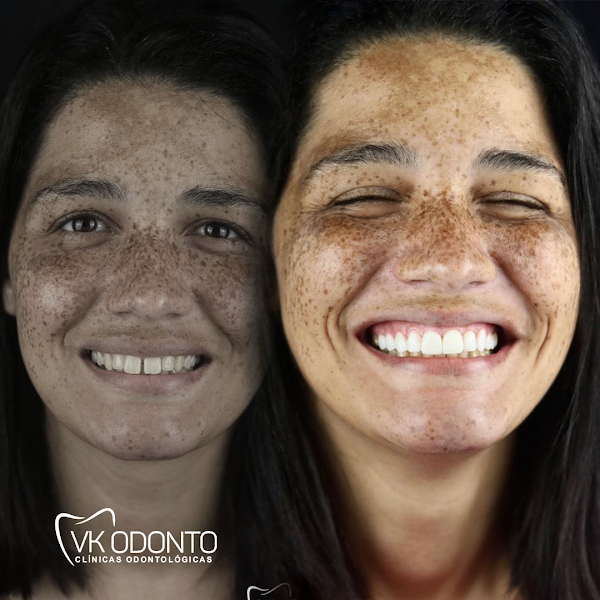 Foto 2 de VK ODONTO - DENTISTA EM SANTANA