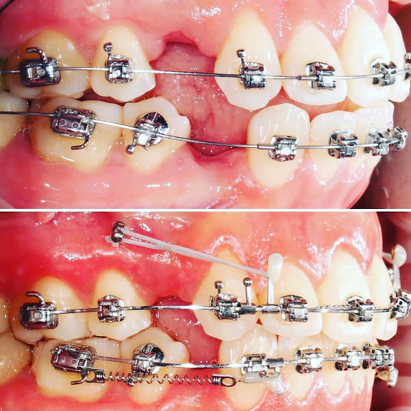 Foto 2 de Voata Odontologia e Estética do Sorriso