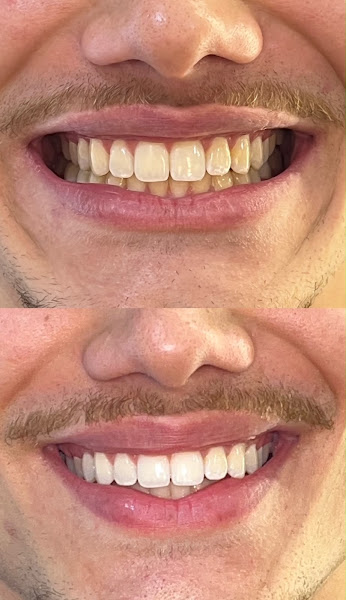 Foto 3 de Voata Odontologia e Estética do Sorriso