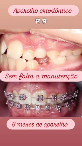 Foto 2 de VOO ODONTO