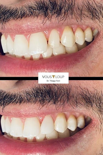 Foto 2 de Vous Loup - Odontologia, Ortodontia e Estética avançada Tristeza