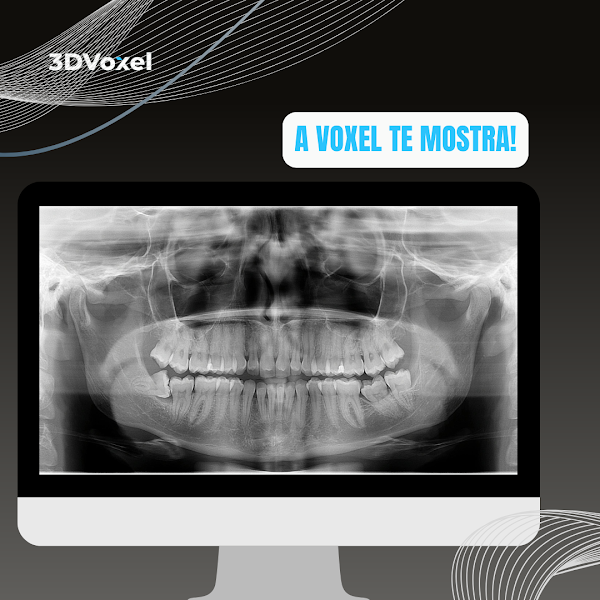 Foto 3 de Voxel Radiodiagnóstico Odontológico