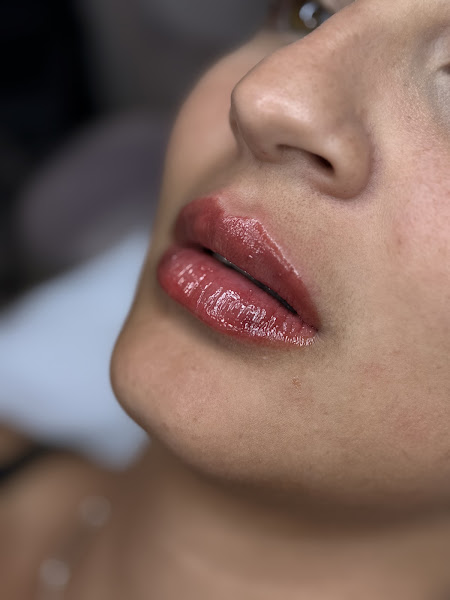 Foto 2 de VS Clinic | Dra. Vitória Sampaio (CRBM 22530)