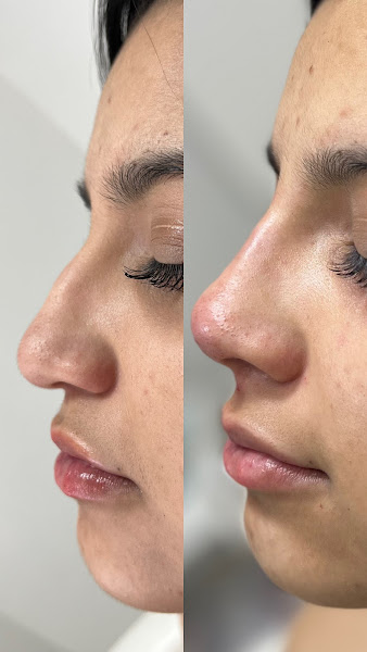 Foto 3 de VS Clinic | Dra. Vitória Sampaio (CRBM 22530)