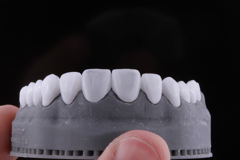 Foto 2 de VT Prótese Dentária