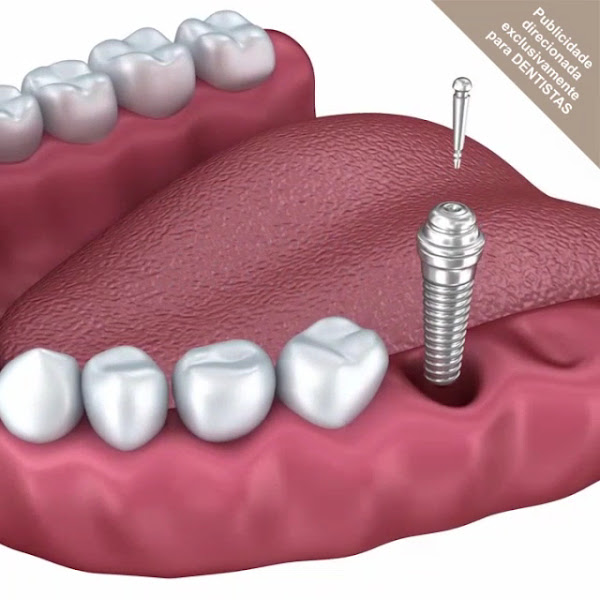 Foto 3 de We Pró Dental Lab