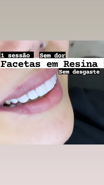 Foto 2 de White - Odontológia & Estética Integrada