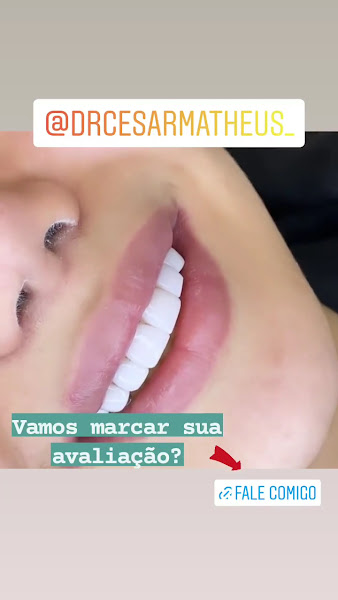 Foto 3 de White - Odontológia & Estética Integrada