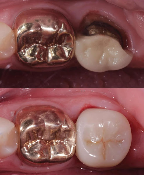 Foto 3 de White Odontologia Integrada - Liliane M. Vizzotto e Juliana M. Vizzotto