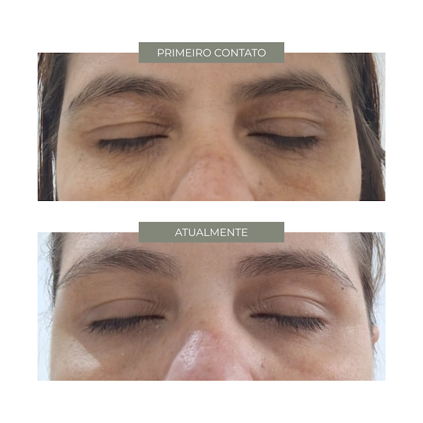 Foto 3 de WILLCARE • Estética Facial Personalizada | Centro, Rio Claro - SP