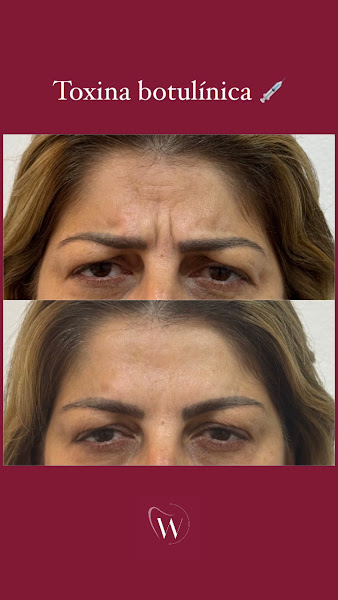 Foto 2 de Winter Odonto - Estética e Odontologia