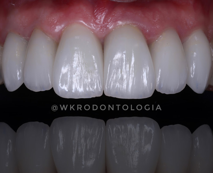 Foto 2 de WK•R ODONTOLOGIA | Dentista Porto Alegre | Lente de Contato Dental / Implante Dentário / Invisalign / Zona Norte Porto Alegre