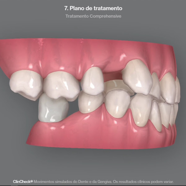 Foto 3 de WK•R ODONTOLOGIA | Dentista Porto Alegre | Lente de Contato Dental / Implante Dentário / Invisalign / Zona Norte Porto Alegre
