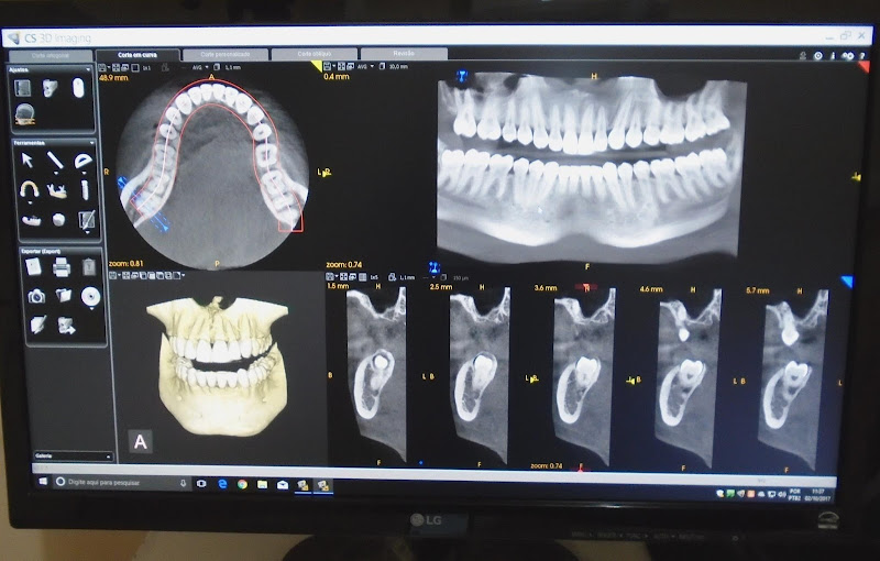 Foto 3 de X Digital Radiologia Odontológica