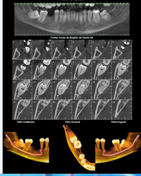 Foto 3 de X-FACE Clínica de Radiologia Odontológica