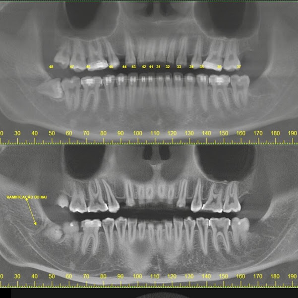 Foto 3 de XSlice Radiologia Tomografia e Diagnóstico Odontológico
