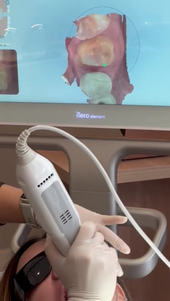 Foto 3 de YASUDA & CAIADO ODONTOLOGIA DIGITAL - DENTISTA HIGIENÓPOLIS - SANTA CECÍLIA